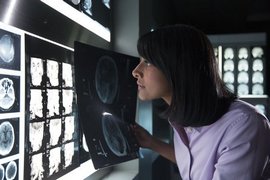 Когнитивната система Watson ще помогне на медиците да проследяват визуално заболяванията на пациентите (снимка: IBM)