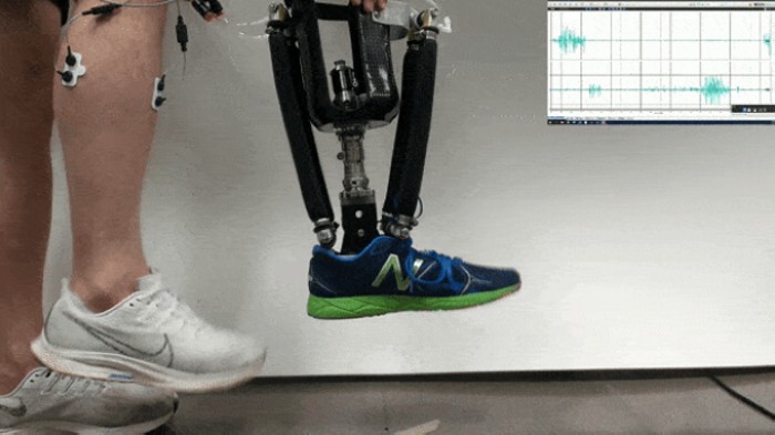 Човек, загубил крака си, може да контролира роботизиран екзоскелет със