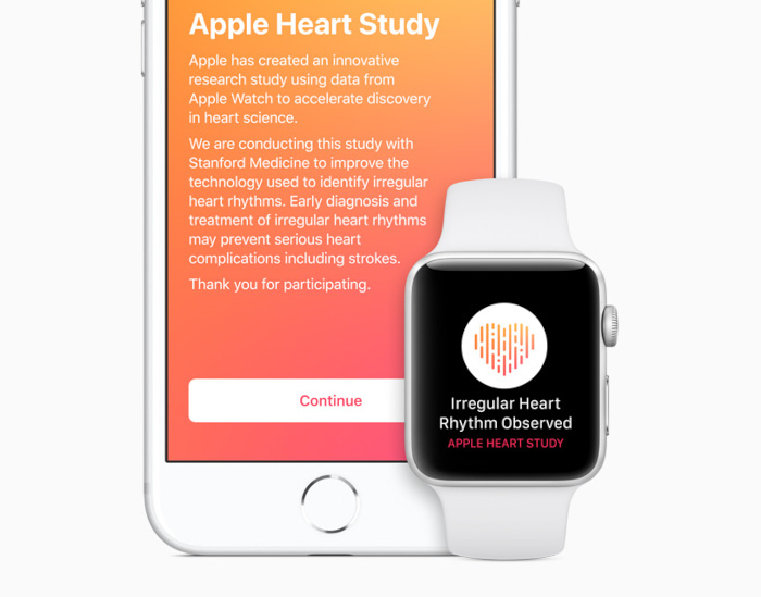 Смарт часовникът диагностицирал предсърдно мъжденеНаучно изследване доказа че Apple Watch