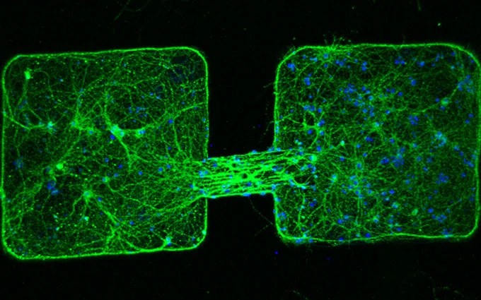 Възстановяване на връзката между две групи от нервни клетки илюстрация DGIST ETH Ново